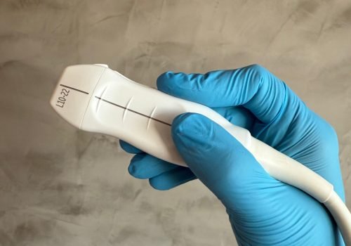 ultrassonografia dermatologica feita por médico especialista Dr. Victor Mol. Atendimento em Niterói e Rio de Janeiro.