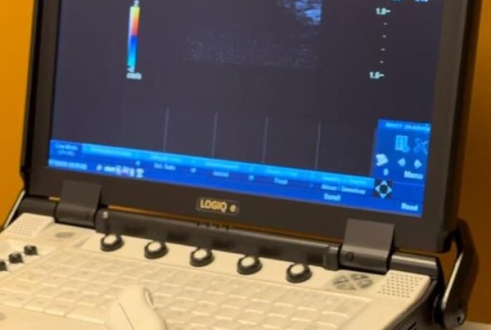 Ultrassonografia em domicílio. Médico especialista Dr. Victor Mol. Atendimento em Niterói e Rio de Janeiro.