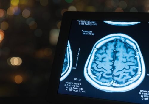 dr. Victor Mol. Radiologia e Diagnósticos por Imagem: Neurorradiologia (segunda opinião para Tomografias e Ressonâncias), Ultrassom Dermatológico e Ultrassom Masculino.